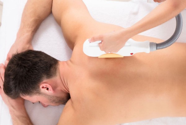 laser uomo acireale e provincia