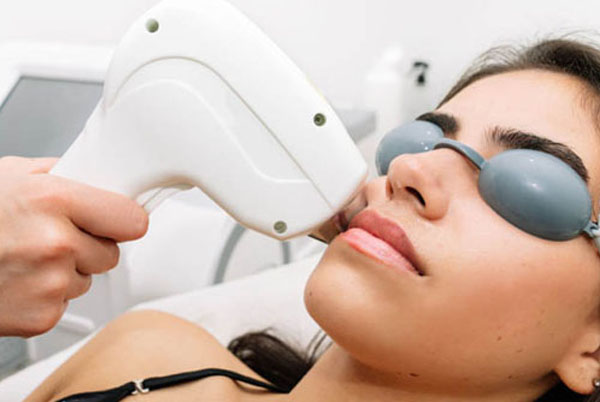 laser donna a acireale